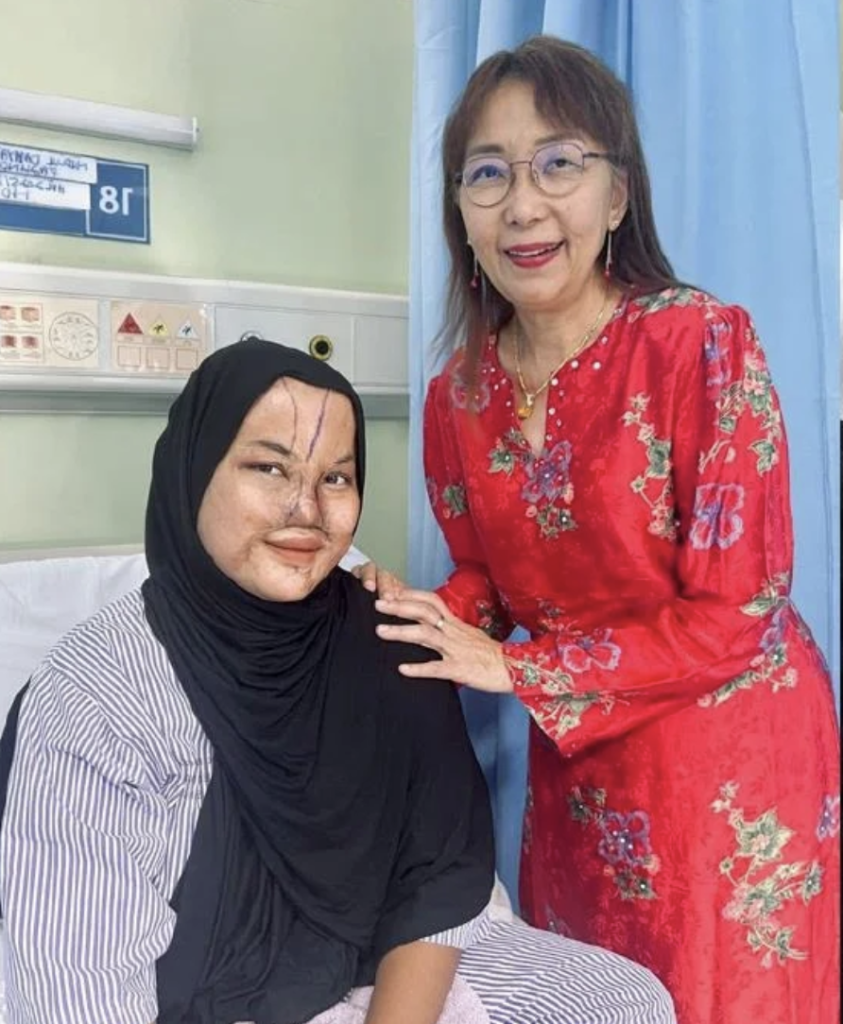 pembedahan hidung